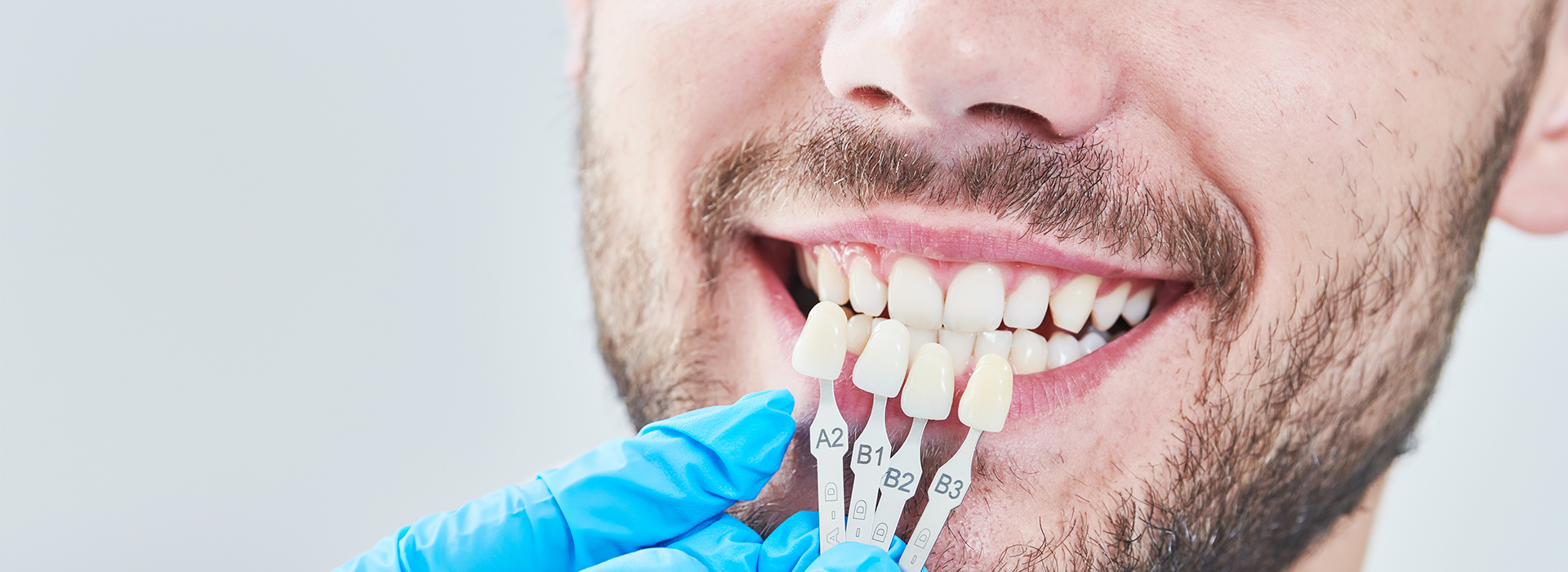 A man in a lab coat smiling at the camera with his teeth being worked on by dental tools.